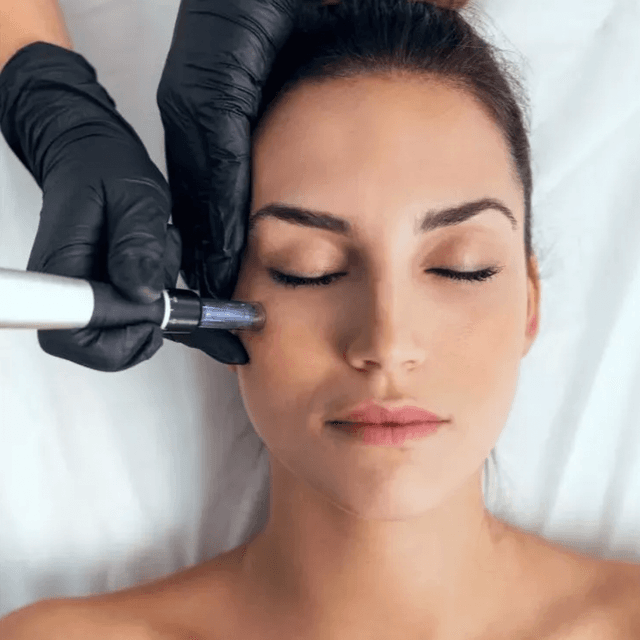 Microneedle Face + Neck (3pk) at Skin by Cydni in Atlanta, GA