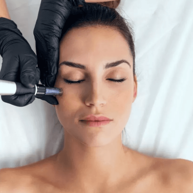 Microneedle face+neck+chest(3pk) at Skin by Cydni in Atlanta, GA